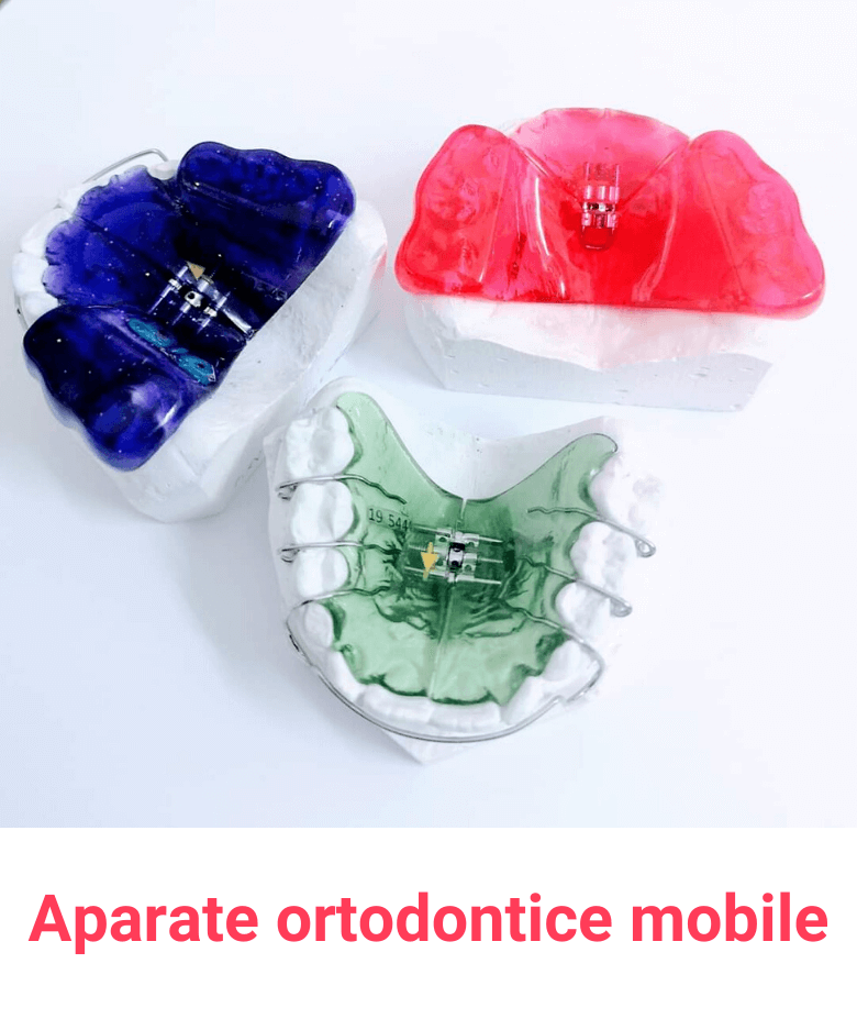 bracket balti (1)